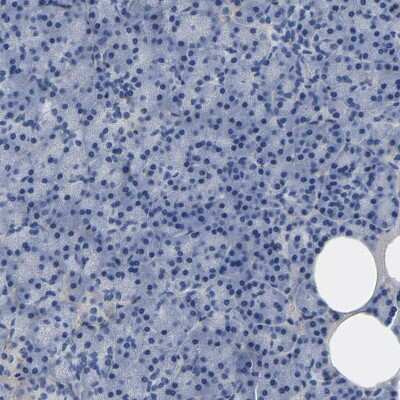Immunohistochemistry-Paraffin: Collagen VI alpha 1 Antibody [NBP1-91195]
