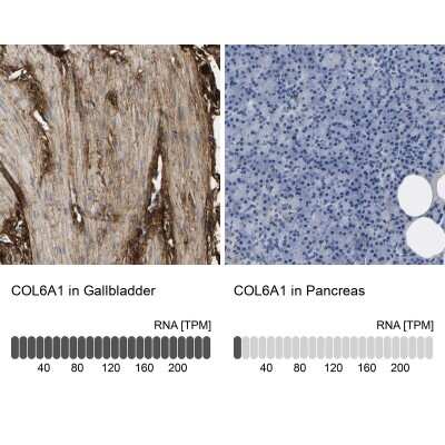 Immunohistochemistry-Paraffin: Collagen VI alpha 1 Antibody [NBP1-91195]