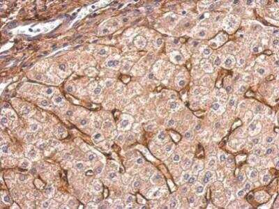 Immunohistochemistry-Paraffin: Collagen VI alpha 1 Antibody [NBP2-15947]