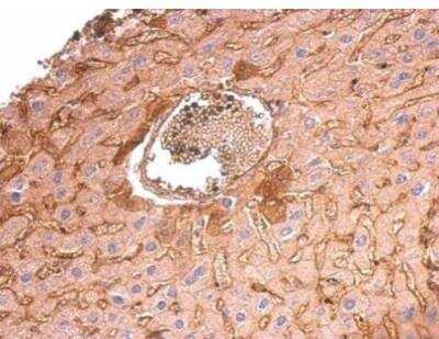 Immunohistochemistry-Paraffin: Collagen VI alpha 1 Antibody [NBP2-15947]