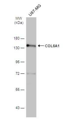Western Blot: Collagen VI alpha 1 Antibody [NBP2-15947]