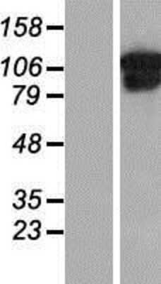 Western Blot: Collagen VI alpha 1 Overexpression Lysate [NBP2-10777]