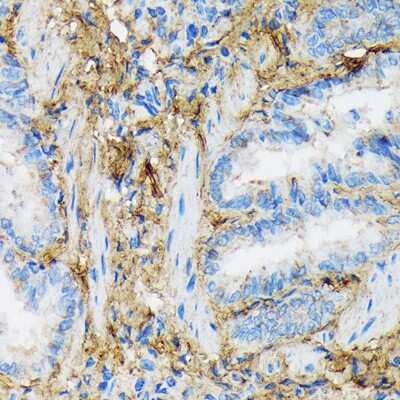 Immunohistochemistry-Paraffin: Collagen VI alpha 1 Antibody (7J1P4) [NBP3-16869]