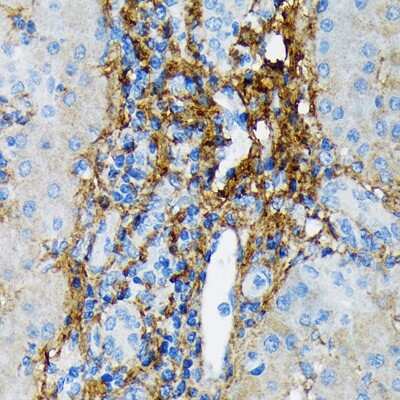 Immunohistochemistry-Paraffin: Collagen VI alpha 1 Antibody (7J1P4) [NBP3-16869]