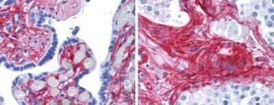 Immunohistochemistry: Collagen VI alpha 1 Antibody [NB120-6588]