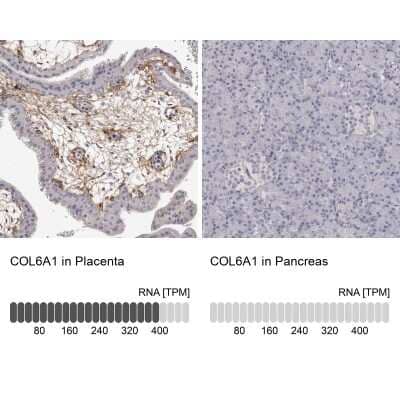 Immunohistochemistry-Paraffin: Collagen VI alpha 1 Antibody [NBP1-91193]