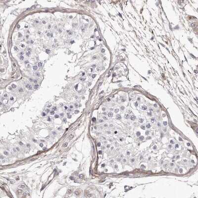 Immunohistochemistry-Paraffin: Collagen VI alpha 1 Antibody [NBP1-91193]