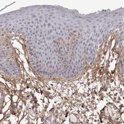 Immunohistochemistry-Paraffin: Collagen VI alpha 1 Antibody [NBP1-91193]