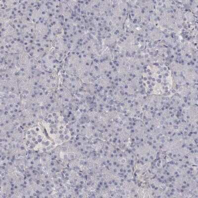 Immunohistochemistry-Paraffin: Collagen VI alpha 1 Antibody [NBP1-91193]