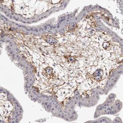 Immunohistochemistry-Paraffin: Collagen VI alpha 1 Antibody [NBP1-91193]