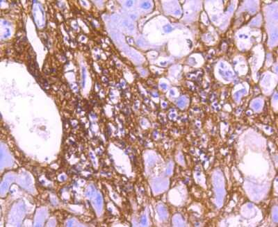 Immunohistochemistry-Paraffin: Collagen VI alpha 1 Antibody (SD83-03) [NBP2-67825]