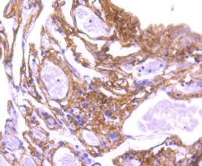 Immunohistochemistry-Paraffin: Collagen VI alpha 1 Antibody (SD83-03) [NBP2-67825]