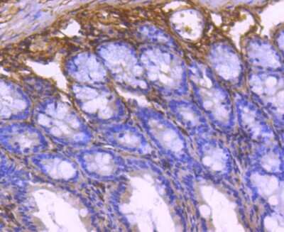 Immunohistochemistry-Paraffin: Collagen VI alpha 1 Antibody (SD83-03) [NBP2-67825]