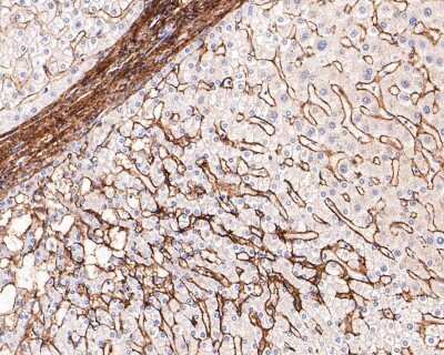Immunohistochemistry-Paraffin: Collagen VI alpha 1 Antibody (SD83-03) [NBP2-67825]