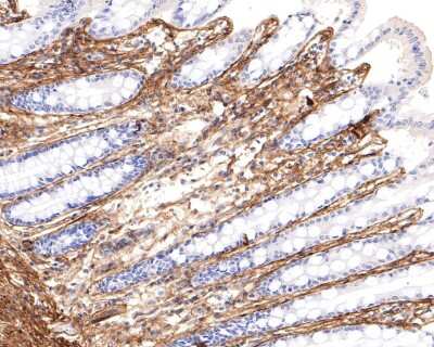 Immunohistochemistry-Paraffin: Collagen VI alpha 1 Antibody (SD83-03) [NBP2-67825]