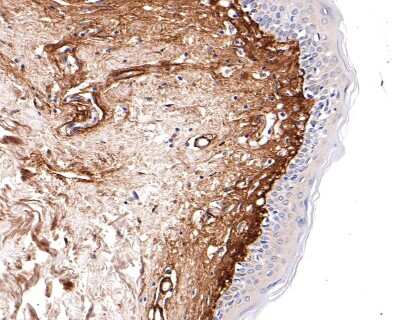 Immunohistochemistry-Paraffin: Collagen VI alpha 1 Antibody (SD83-03) [NBP2-67825]