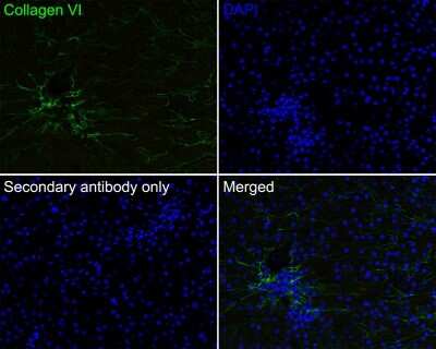 Immunohistochemistry-Paraffin: Collagen VI alpha 1 Antibody (SD83-03) [NBP2-67825]