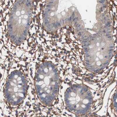 Immunohistochemistry-Paraffin: Collagen VI alpha 2 Antibody [NBP1-90951]