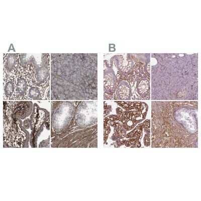 Immunohistochemistry-Paraffin: Collagen VI alpha 2 Antibody [NBP1-90951]