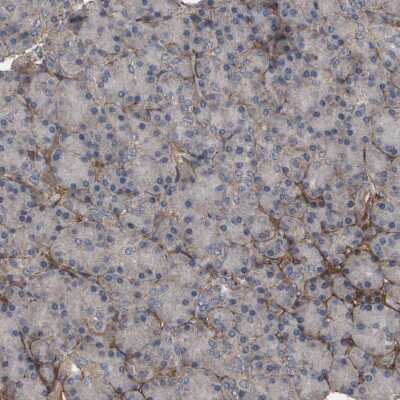 Immunohistochemistry-Paraffin: Collagen VI alpha 2 Antibody [NBP1-90951]