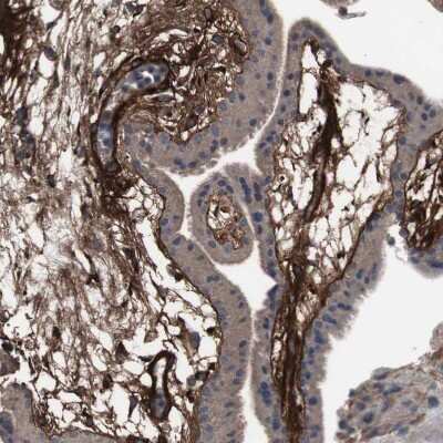 Immunohistochemistry-Paraffin: Collagen VI alpha 2 Antibody [NBP1-90951]
