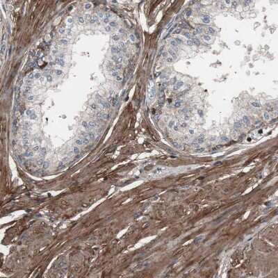 Immunohistochemistry-Paraffin: Collagen VI alpha 2 Antibody [NBP1-90951]