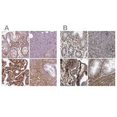 Immunohistochemistry-Paraffin: Collagen VI alpha 2 Antibody [NBP2-55655]