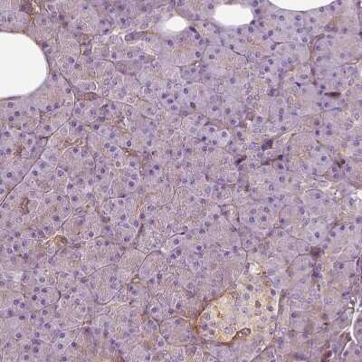Immunohistochemistry-Paraffin: Collagen VI alpha 2 Antibody [NBP2-55655]