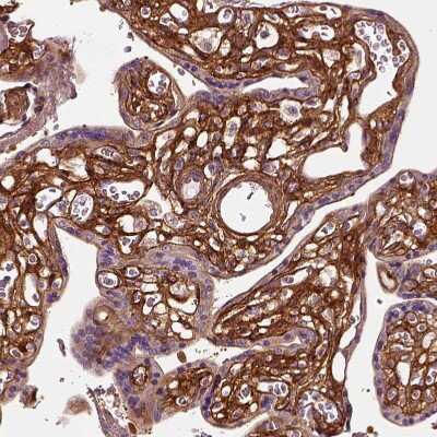 Immunohistochemistry-Paraffin: Collagen VI alpha 2 Antibody [NBP2-55655]