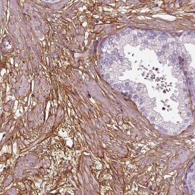 Immunohistochemistry-Paraffin: Collagen VI alpha 2 Antibody [NBP2-55655]