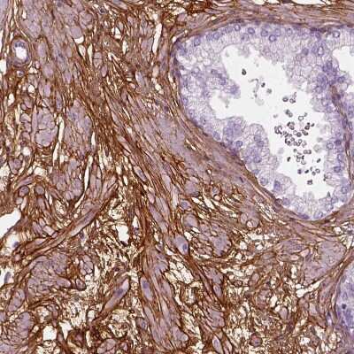 Immunohistochemistry-Paraffin: Collagen VI alpha 2 Antibody [NBP2-58879]