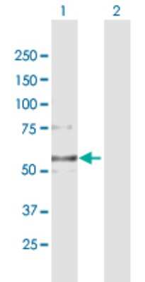 Western Blot: Collagen VI alpha 2 Antibody [H00001292-B02P]