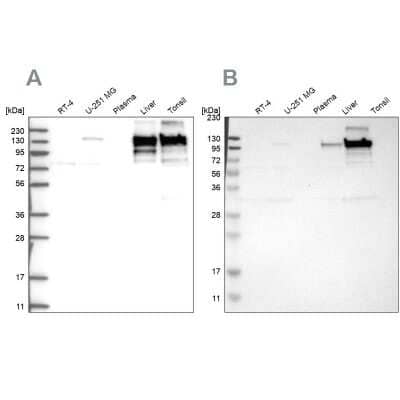 Western Blot: Collagen VI alpha 2 Antibody [NBP2-55655]