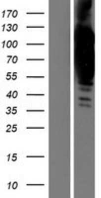 Western Blot: Collagen VI alpha 2 Overexpression Lysate [NBP2-05798]