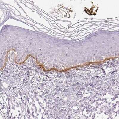 Immunohistochemistry-Paraffin: Collagen VII Antibody [NBP2-37900]