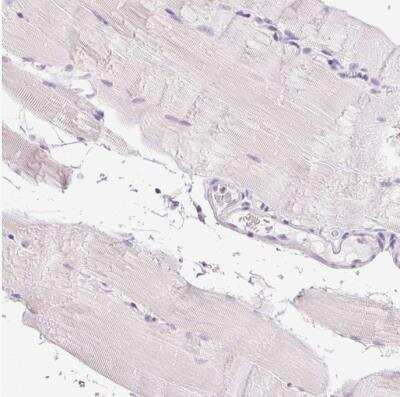 Immunohistochemistry-Paraffin: Collagen VII Antibody [NBP2-37900]