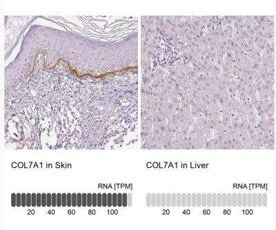 Immunohistochemistry-Paraffin: Collagen VII Antibody [NBP2-37900]