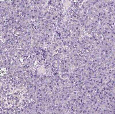 Immunohistochemistry-Paraffin: Collagen VII Antibody [NBP2-37900]