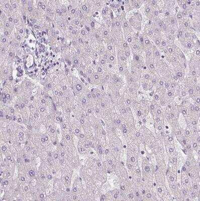 Immunohistochemistry-Paraffin: Collagen VII Antibody [NBP2-37900]