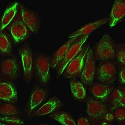 Immunocytochemistry/ Immunofluorescence: Collagen VII Antibody (LH7.2) - Azide and BSA Free [NBP3-08278]