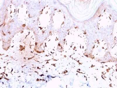 Immunohistochemistry-Paraffin: Collagen VII Antibody (LH7.2) - Azide and BSA Free [NBP3-08278]