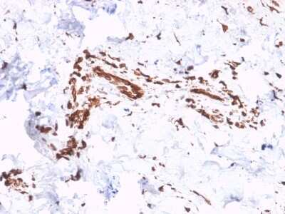 Immunohistochemistry-Paraffin: Collagen VII Antibody (LH7.2) - Azide and BSA Free [NBP3-08278]