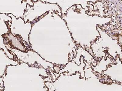 Immunohistochemistry-Paraffin: Collagen VIII alpha 1 Antibody [NBP2-97252]