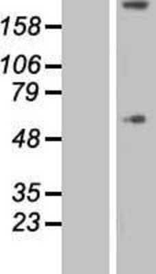 Western Blot: Collagen VIII alpha 1 Overexpression Lysate [NBL1-09357]