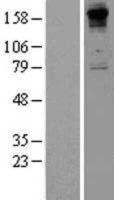 Western Blot: Collagen VIII alpha 1 Overexpression Lysate [NBP2-11331]