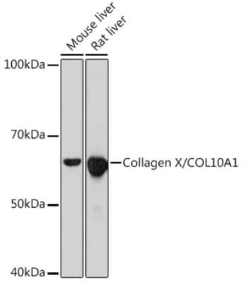 Western Blot: Collagen X alpha 1 Antibody (0F5Q9) [NBP3-15419]