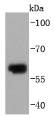 Western Blot: Collagen X alpha 1 Antibody (JF0961) [NBP2-66988]