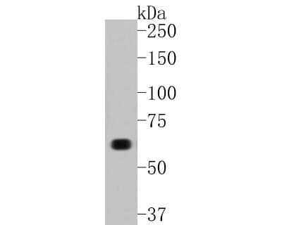 Western Blot: Collagen X alpha 1 Antibody (JF0961) [NBP2-66988]