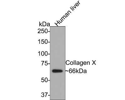 Western Blot: Collagen X alpha 1 Antibody (JF0961) [NBP2-66988]