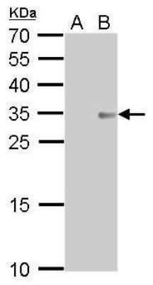 Western Blot: Collagen XI alpha 2 Antibody (212) [NBP2-43747]
